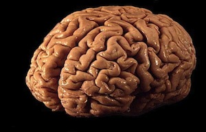 a brain